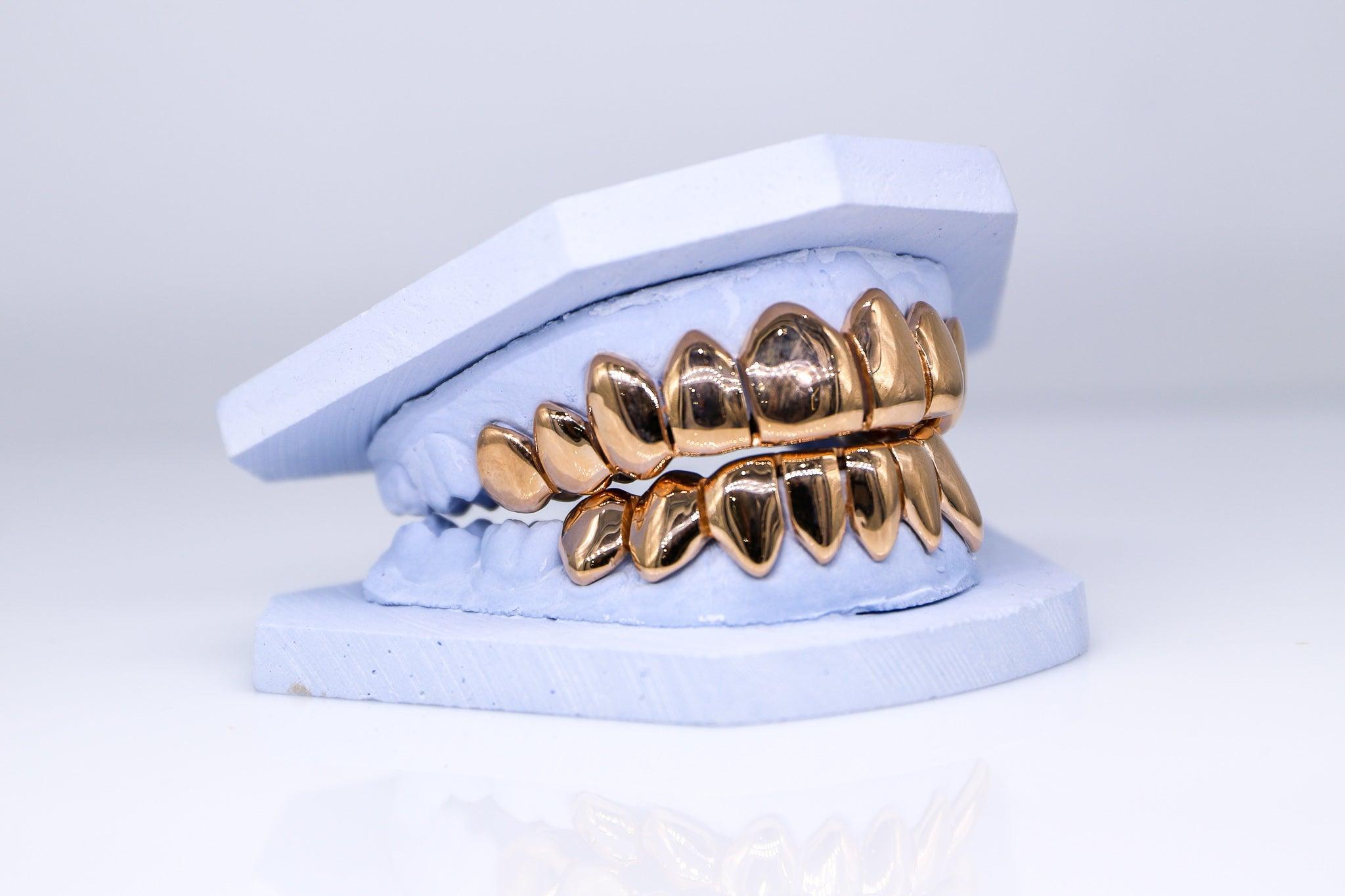 Solid Gold Grillz - Moissanite Bazaar - moissanitebazaar.com