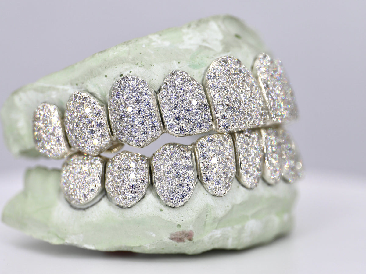 Moissanite Grillz – Page 2 – Moissanite Bazaar