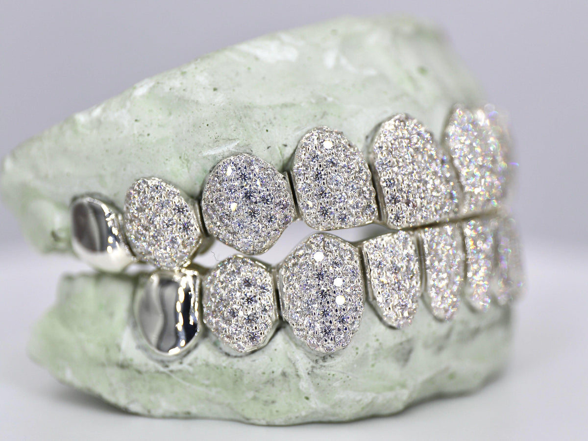 10 on 10 Capped VVS Moisannite Diamond Grillz – Moissanite Bazaar