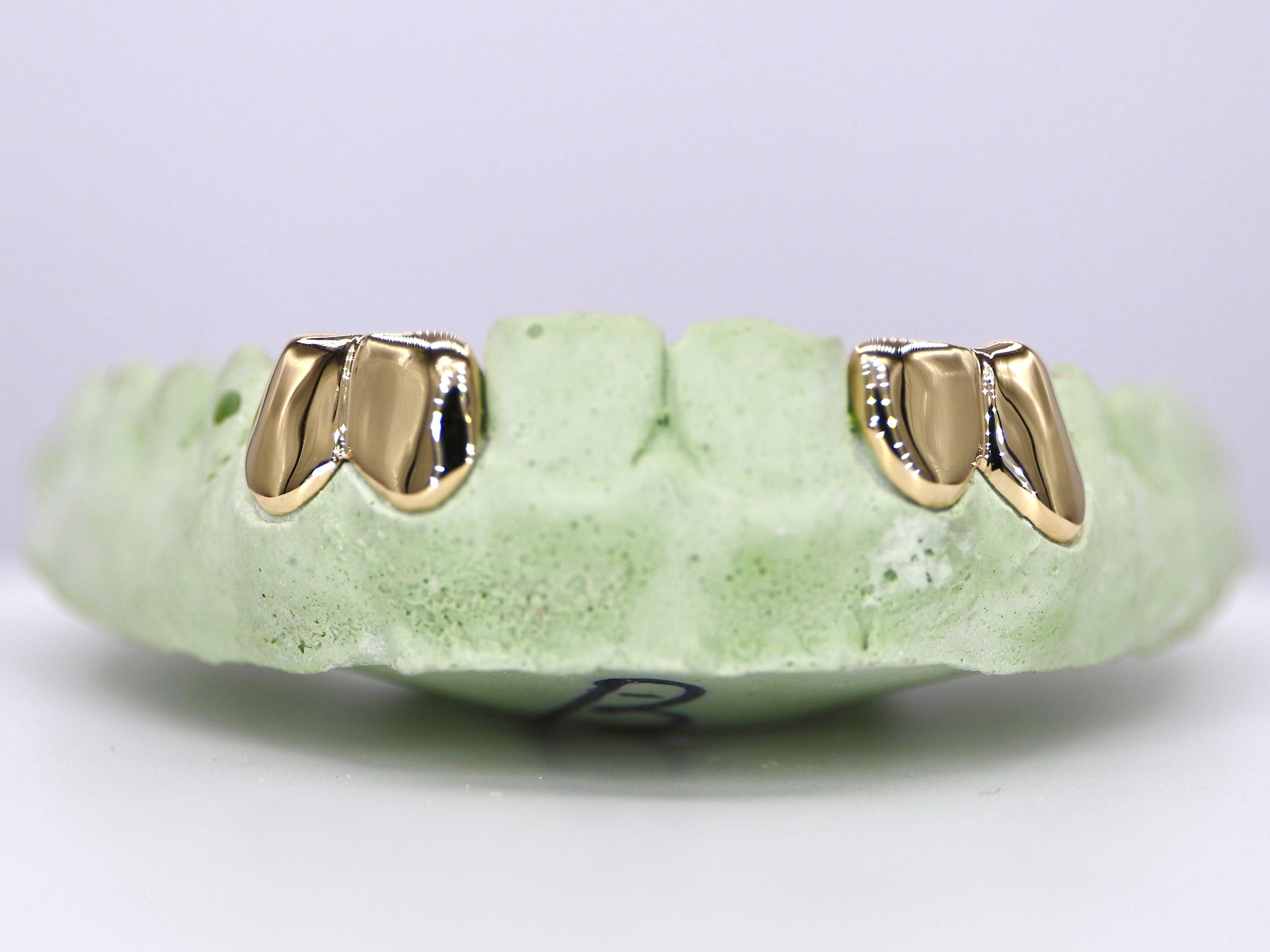 Diamond Dust Grillz – Moissanite Bazaar