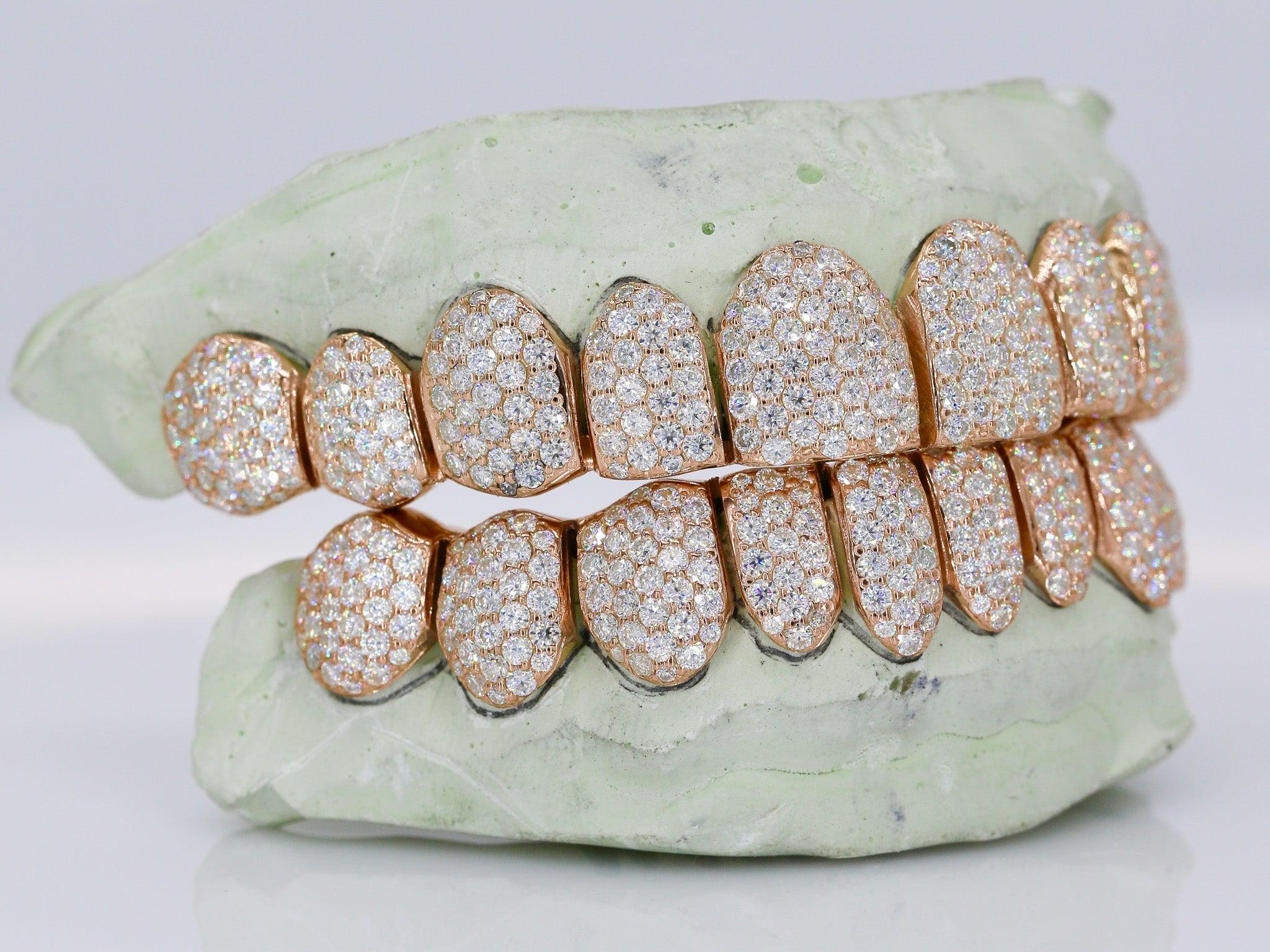 10 on 10 VVS Moisannite Diamond Grillz – Moissanite Bazaar