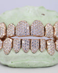 8 on 8 VVS Moissanite Diamond Grillz - Moissanite Bazaar - moissanitebazaar.com