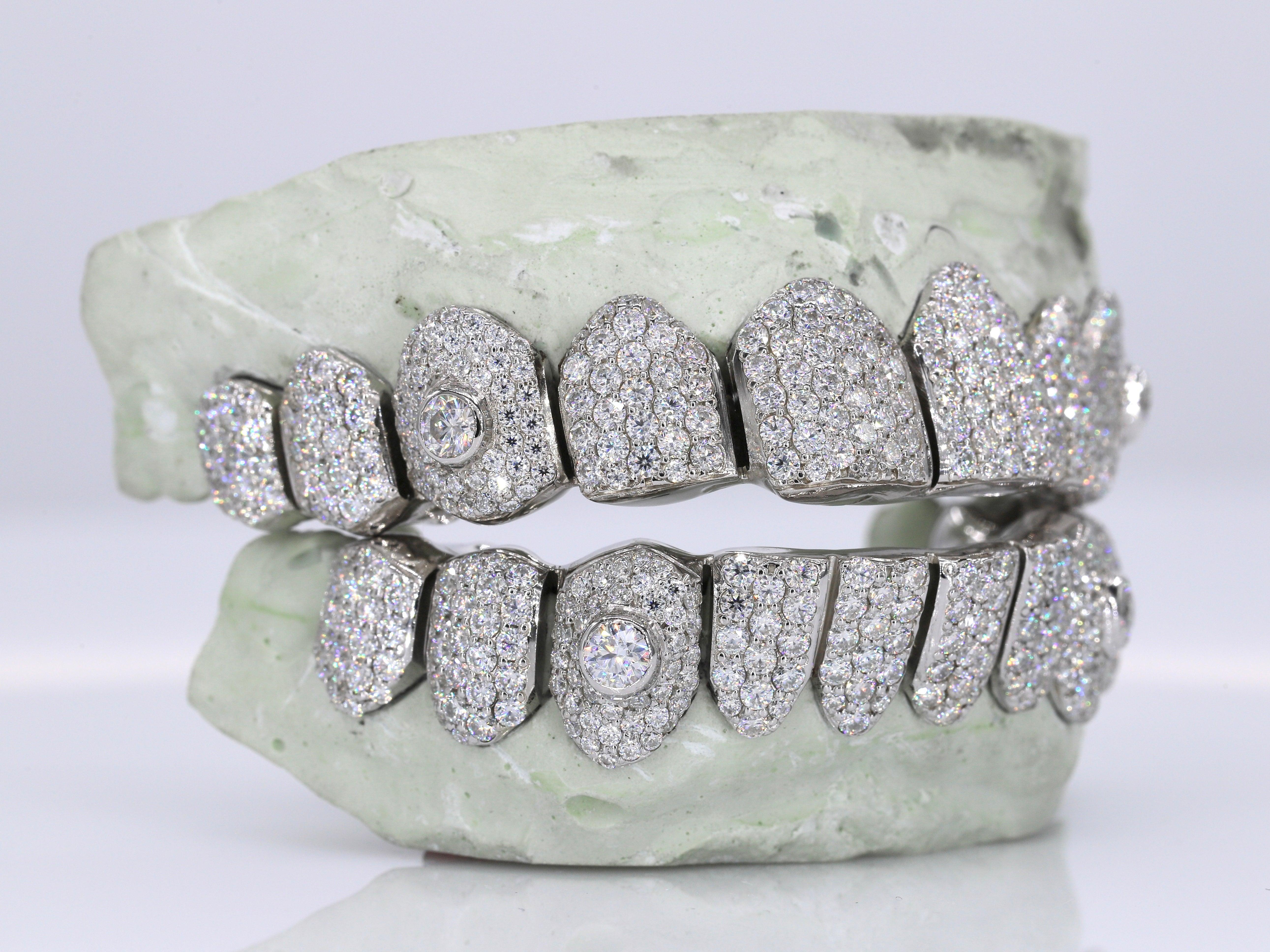 Big Stone VVS Moissanite Diamond Grillz – Moissanite Bazaar