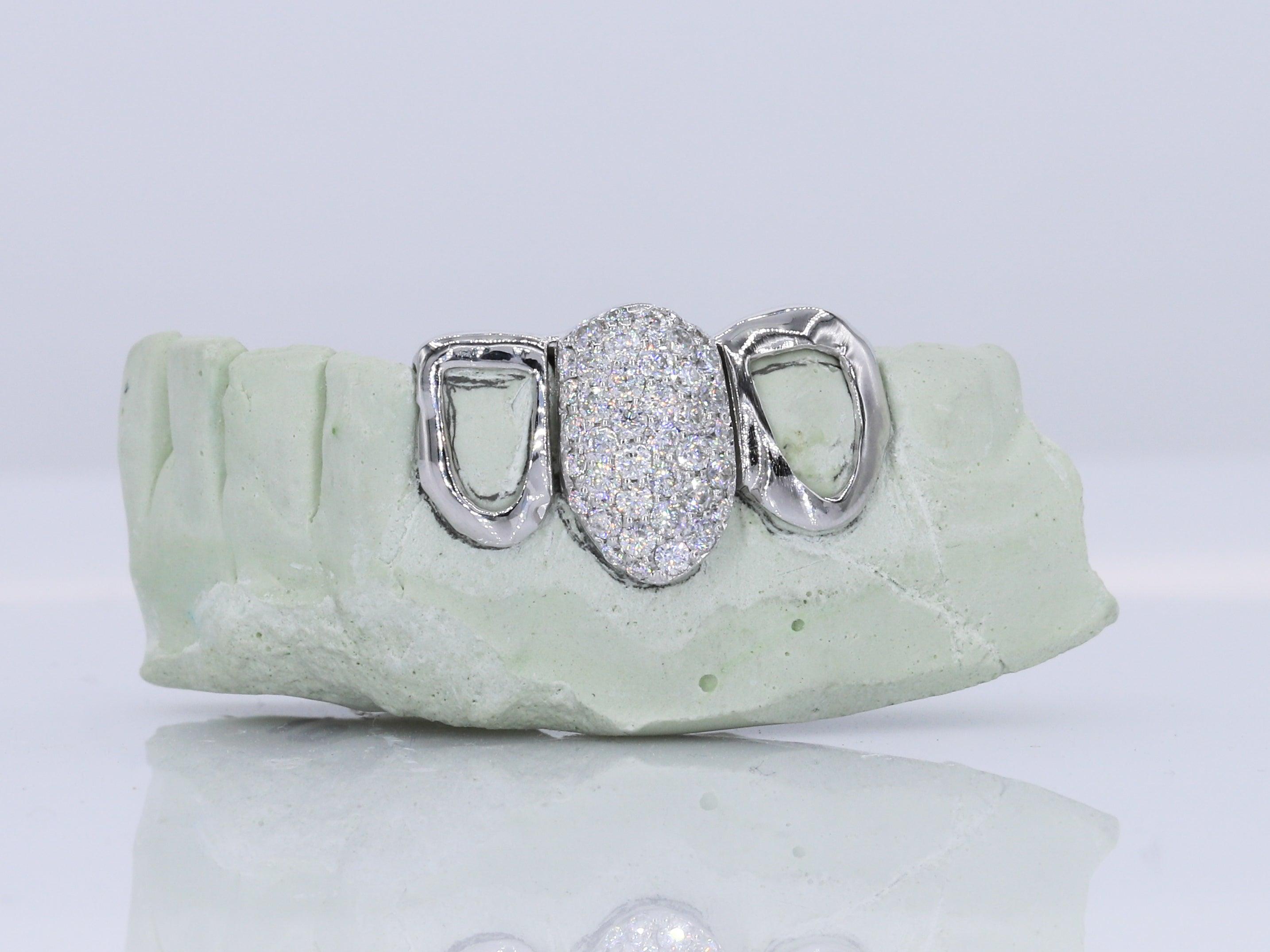 1 Tooth Diamond &amp; 2 Teeth Open Faced VVS Moissanite Diamond Grillz - Moissanite Bazaar - moissanitebazaar.com