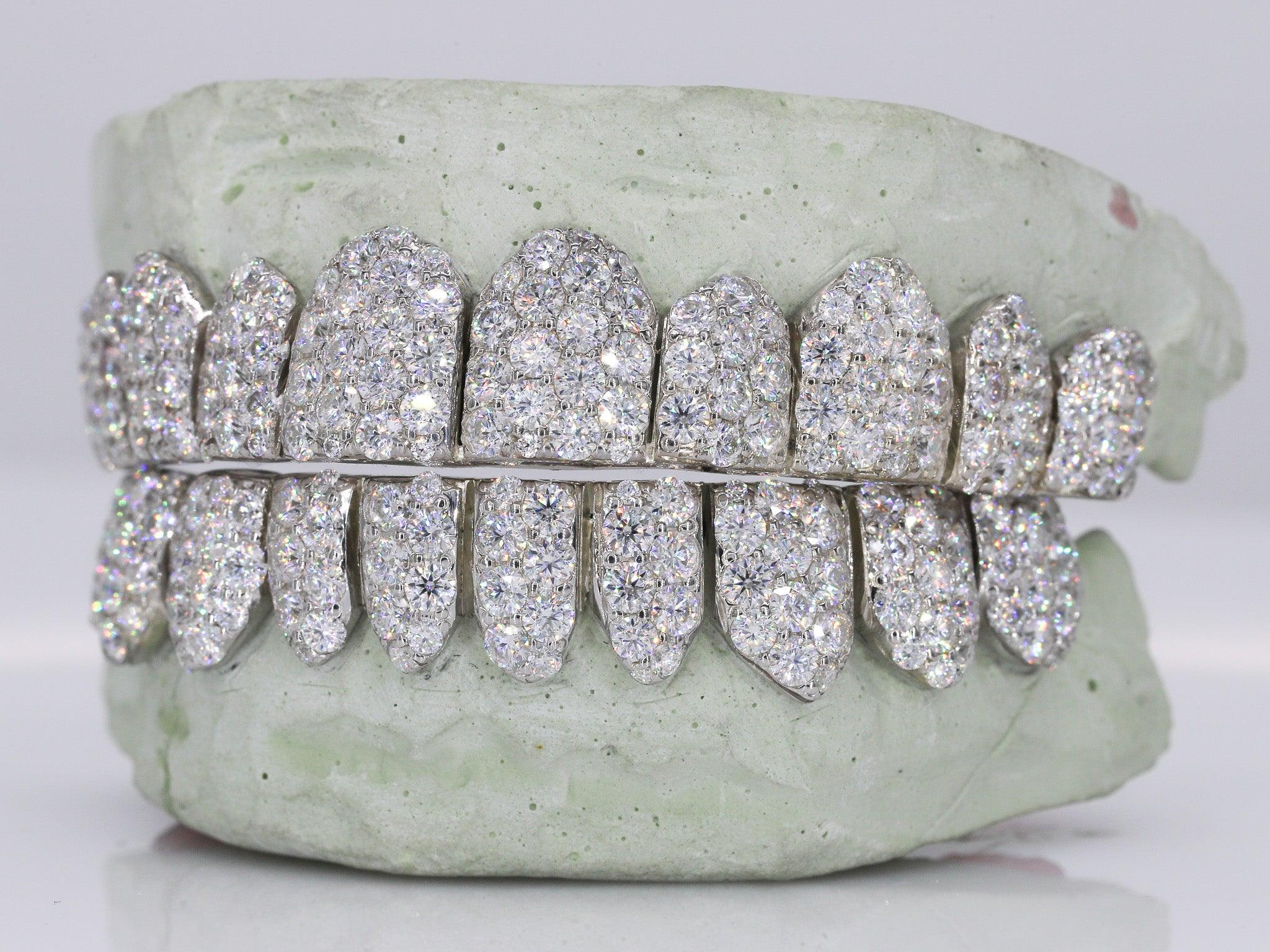 Jumbo VVS Moissanite Diamond Grillz – Moissanite Bazaar