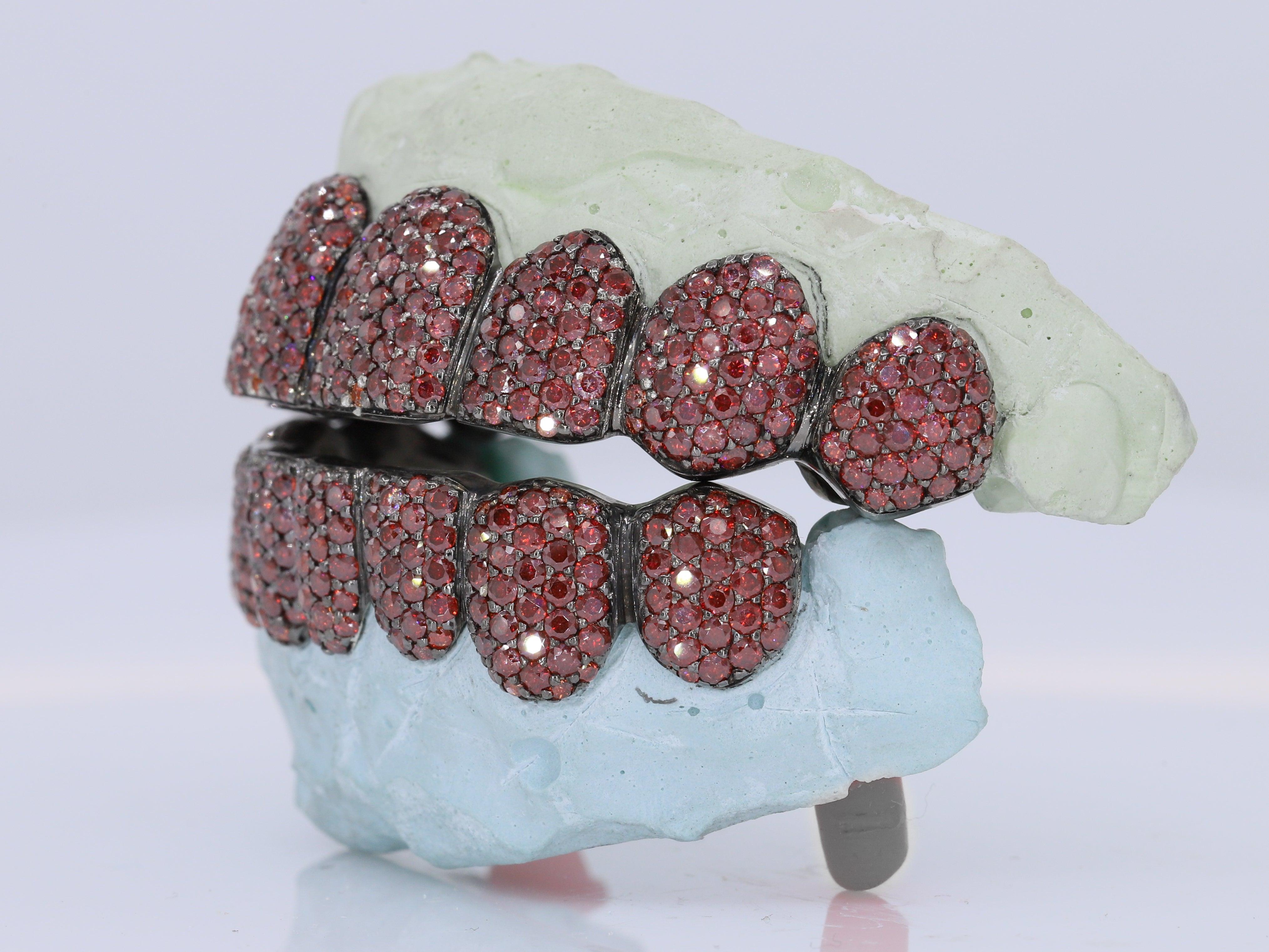 Blood Red VVS Moissanite Diamond Grillz – Moissanite Bazaar