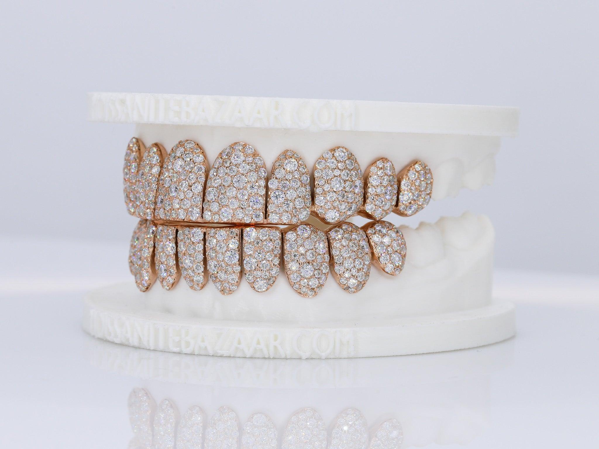 Mosaic/Snow VVS Moissanite Diamond Grillz – Moissanite Bazaar