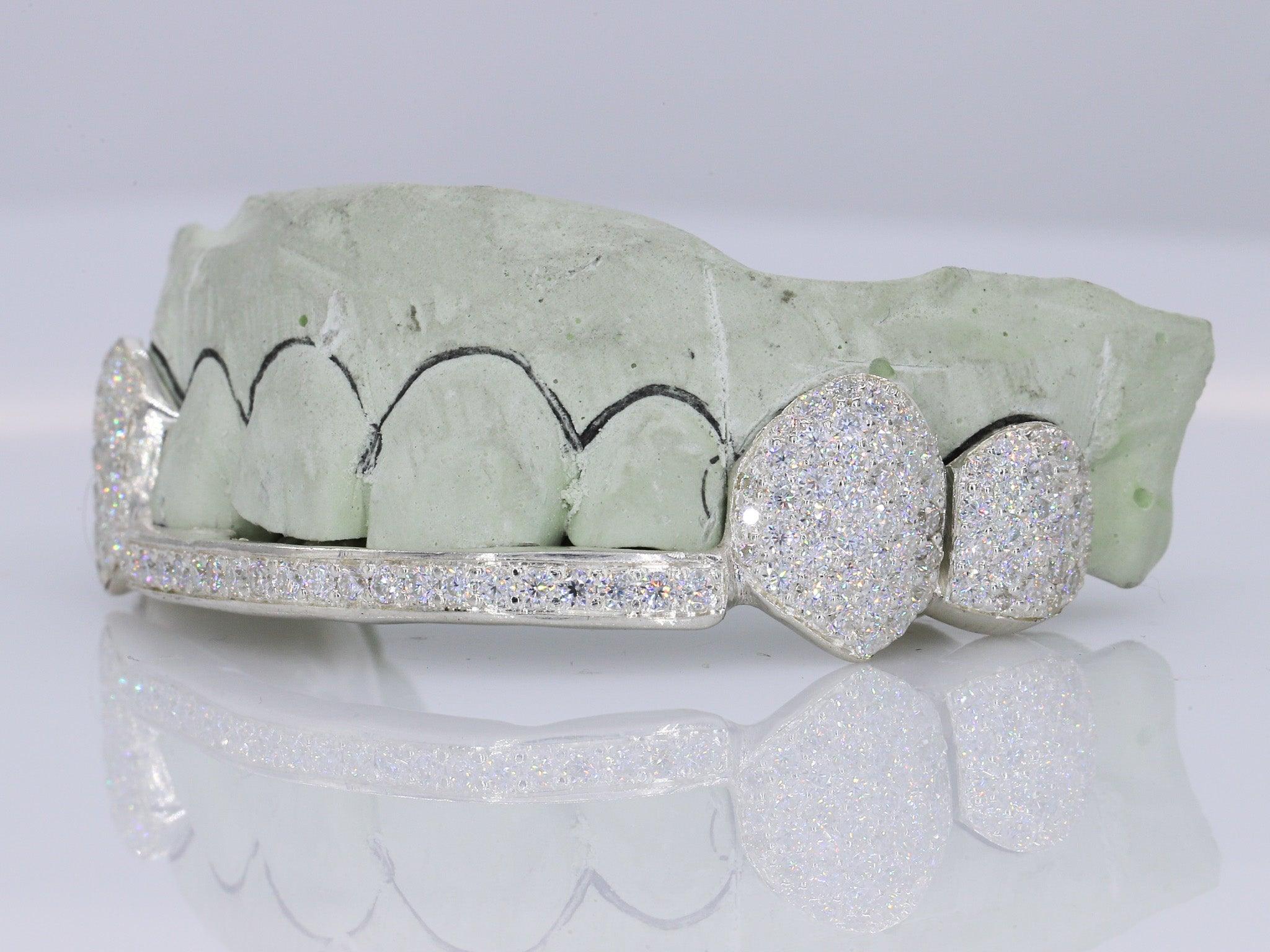 Diamond Fangs & Bar VVS Moissanite Diamond Grillz – Moissanite Bazaar
