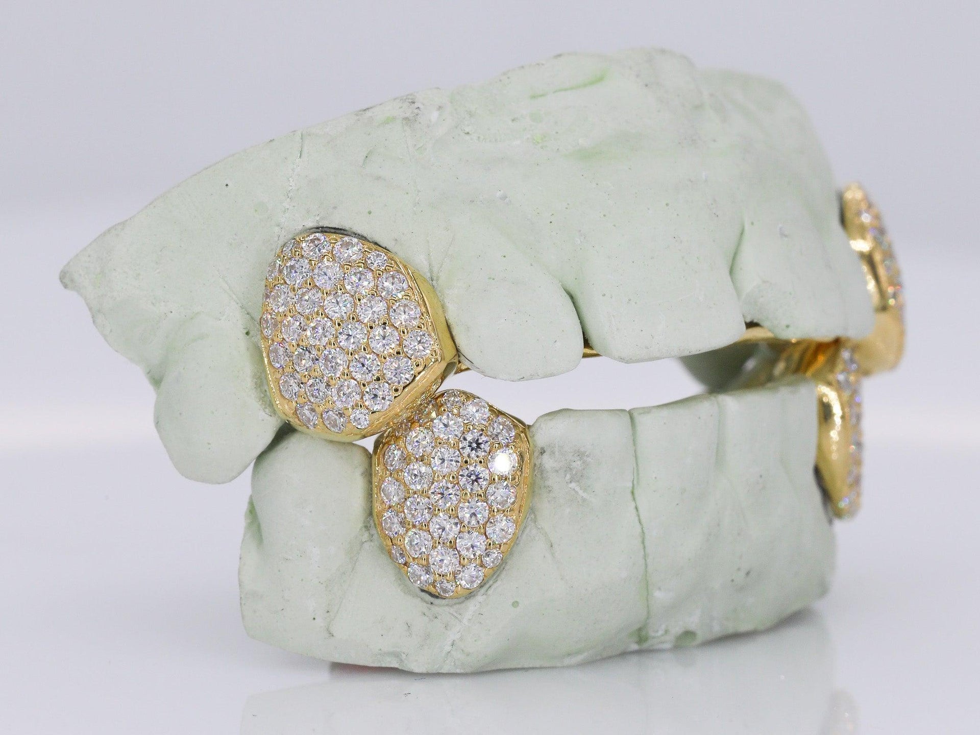 Diamond Fangs VVS Moissanite Diamond Grillz – Moissanite Bazaar