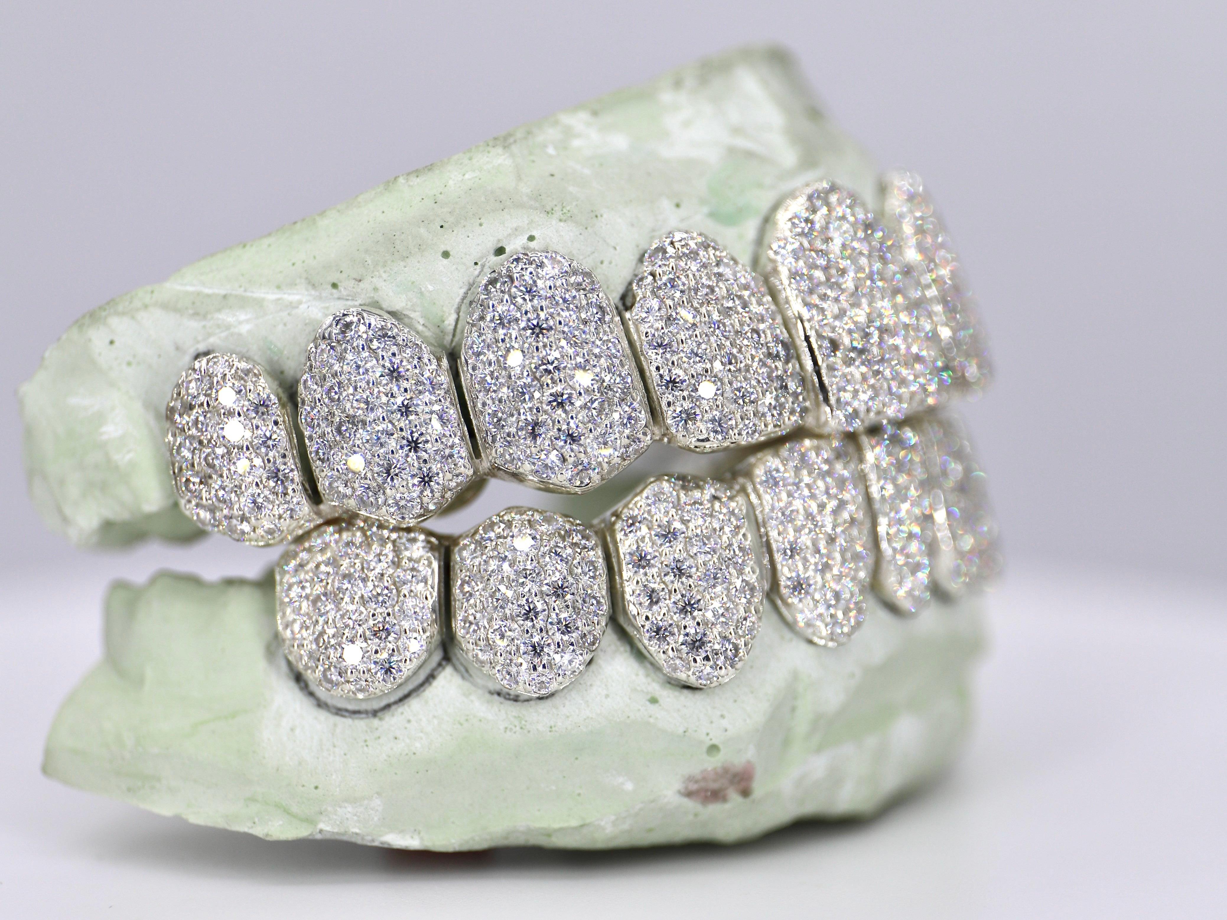 Diamond Dust Grillz – Moissanite Bazaar