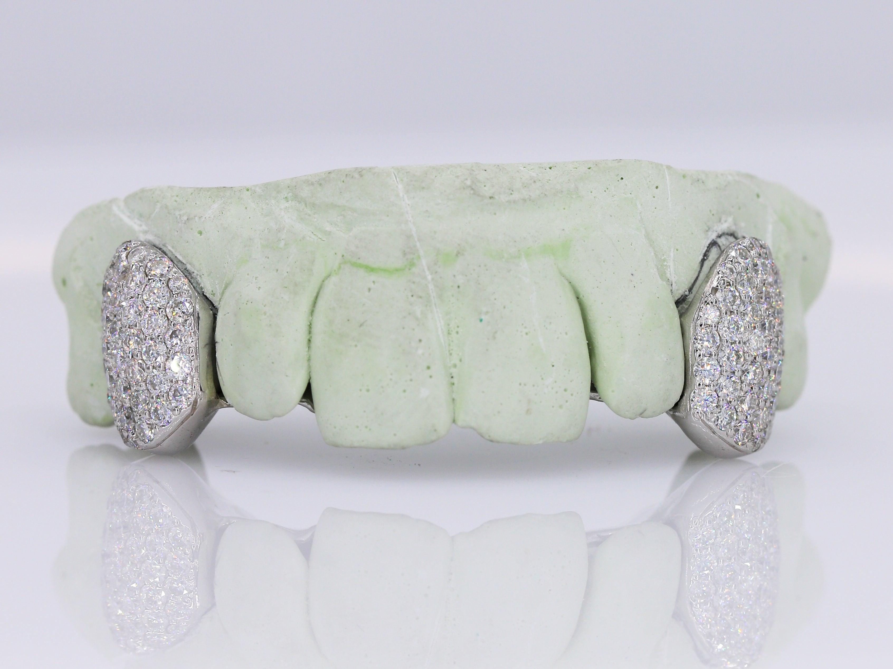 Diamond Fangs VVS Moissanite Diamond Grillz – Moissanite Bazaar