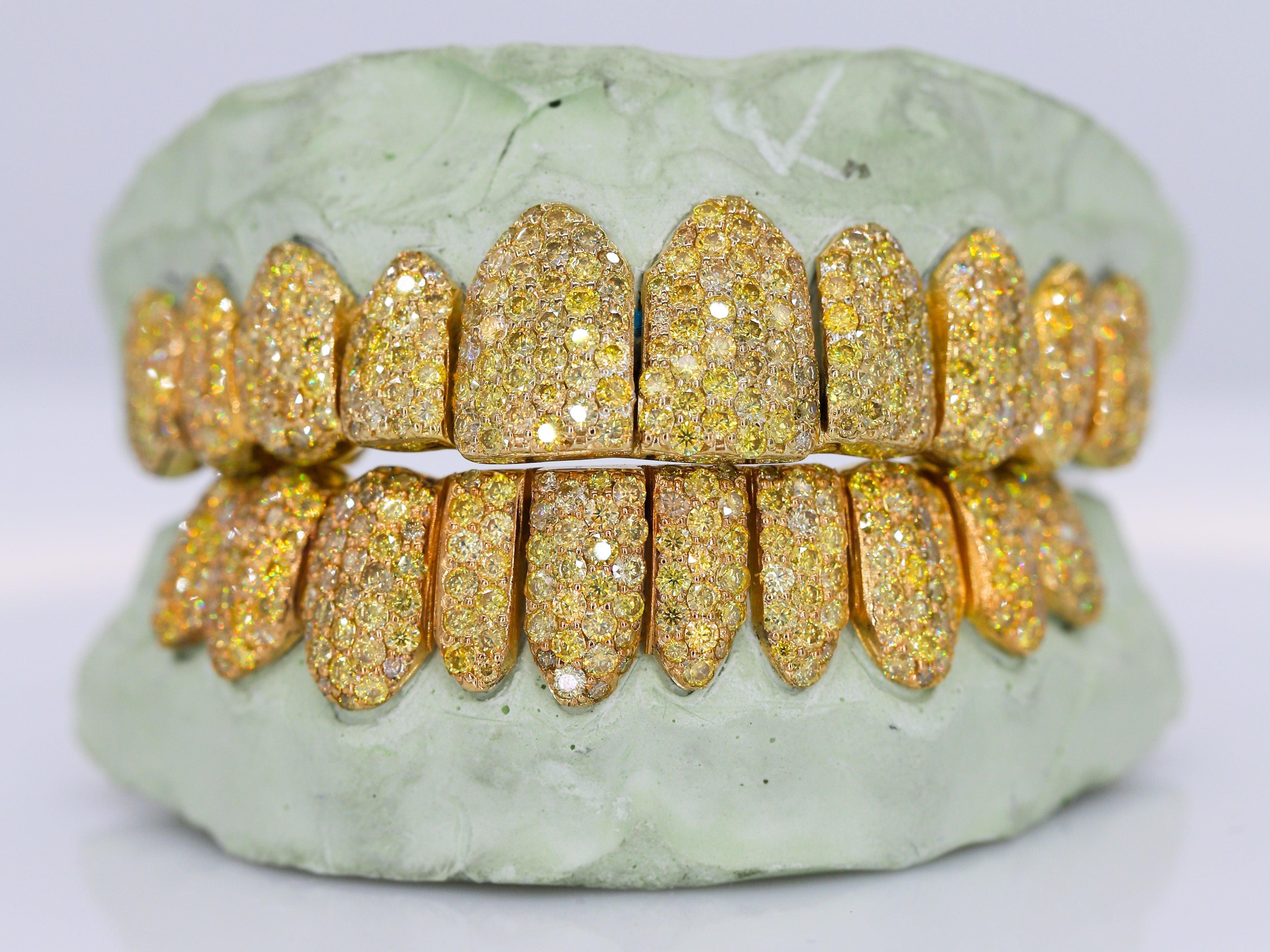 Canary Yellow VVS Moissanite Diamond Grillz - Moissanite Bazaar - moissanitebazaar.com