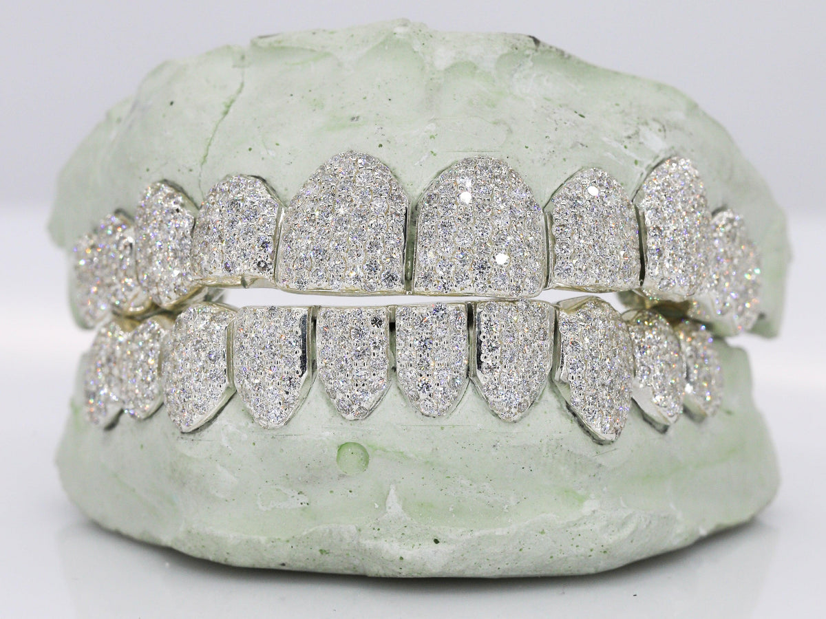 VVS Lab Diamond Grillz – Moissanite Bazaar