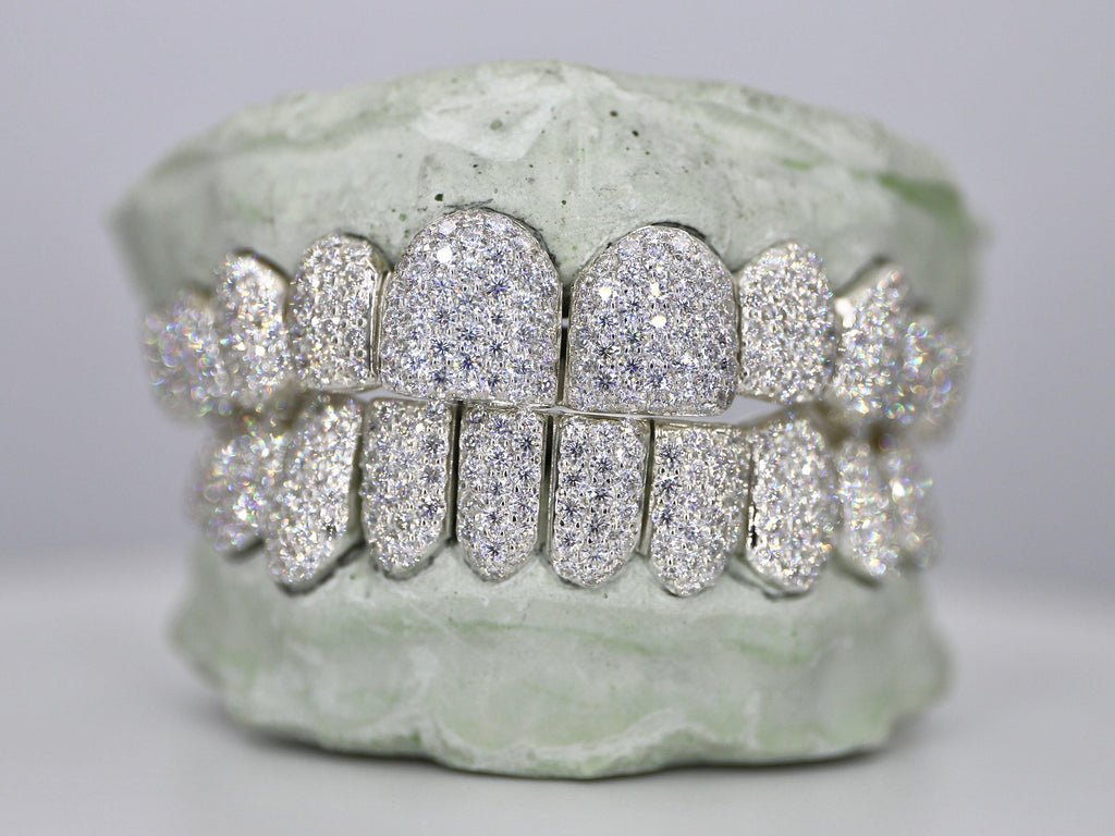 Customizable VVS Moissanite Diamond Grillz – Moissanite Bazaar