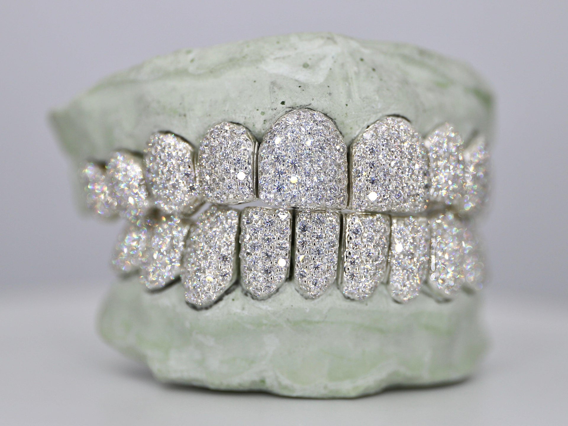 Customizable VVS Moissanite Diamond Grillz – Moissanite Bazaar