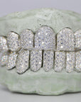 Custom Moissanite Diamond Grillz - Moissanite Bazaar - moissanitebazaar.com