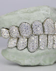 Custom Moissanite Diamond Grillz - Moissanite Bazaar - moissanitebazaar.com