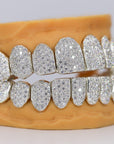 Custom Permanent VVS Moissanite Diamond Grillz - Moissanite Bazaar - moissanitebazaar.com