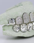 Diamond Top and Diamond Cut Bottom VVS Moisannite Diamond Grillz - Moissanite Bazaar - moissanitebazaar.com